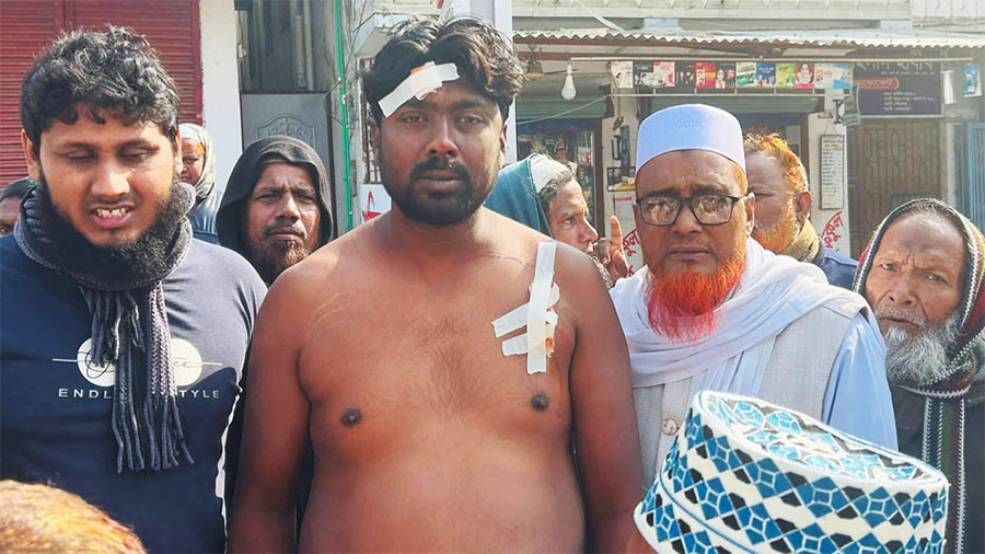 এত ভোট পেল কীভাবে- বলেই সাত সকালে তিন জামায়াত কর্মীকে বেধড়ক পেটালো বিএনপির কর্মীরা