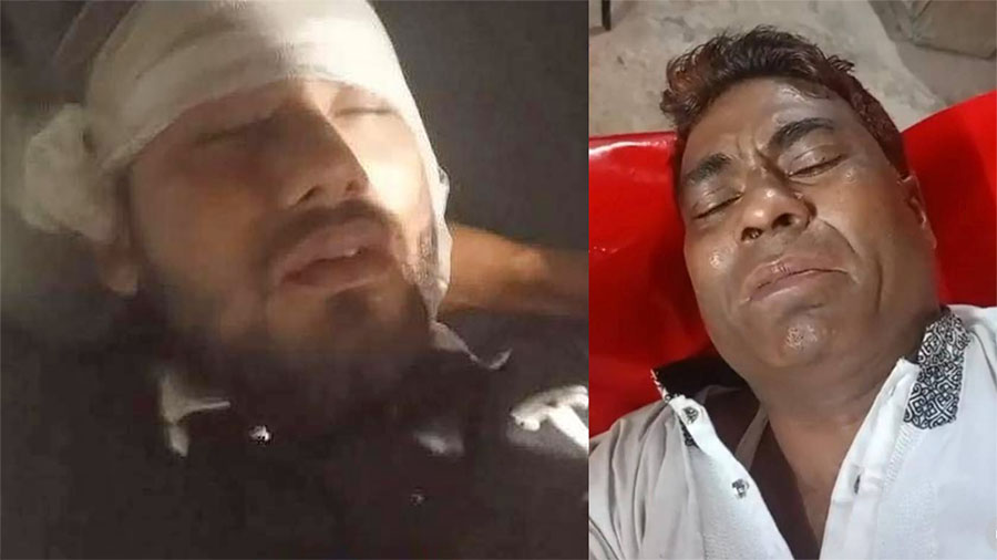 ফেনীতে মাদক ব্যবসা ও চাঁদাবাজির জেরে বিএনপির দলীয় কোন্দল-গোলাগুলি: ৫ নেতাকর্মী আহত