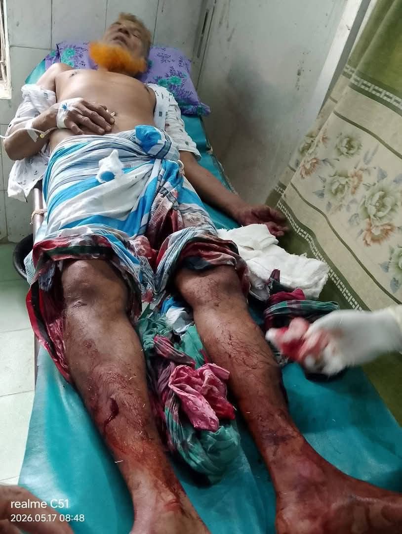 শরীয়তপুরে ছেলে ছাত্রলীগ করায় পিতাকে কুপিয়ে জখমের অভিযোগ