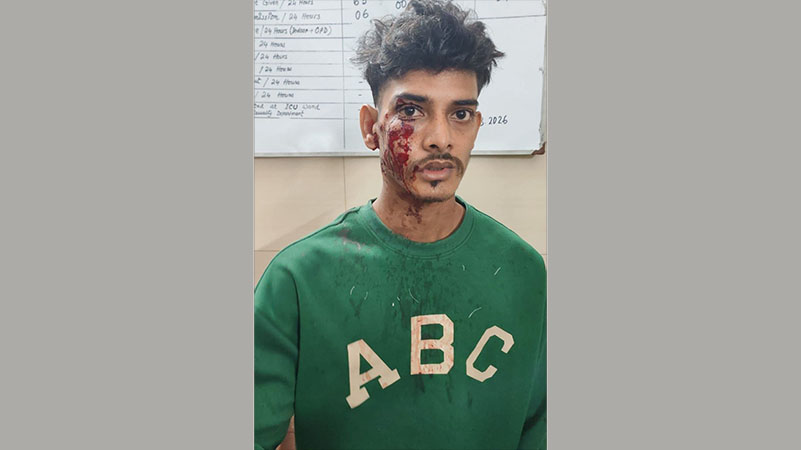 হাটহাজারীতে প্রকাশ্য দিবালোকে গুলি বর্ষণ: আহত-১, এলাকায় চরম আতঙ্ক
