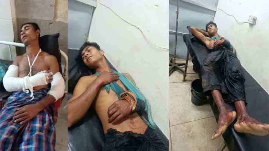 রাঙ্গুনিয়ায় চাঁদা না পেয়ে প্রবাসীর পরিবারে বর্বরোচিত হামলা: শিশুসহ গুলিবিদ্ধ-আহত ৫, আতঙ্কে জনশূন্য এলাকা